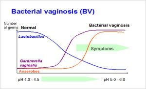 Bacterial Vaginosis MCW Healthcare